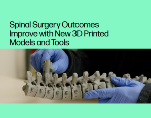 Spinal Surgery Outcomes Improve with New 3D Printed Models and Tools