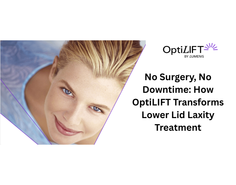No-Surgery-No-Downtime-How-OptiLIFT-Transforms-Lower-Lid-Laxity-Treatment-1